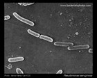 pseudomonas aeruginosa SEM